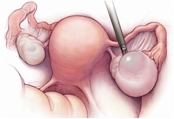 �ѳ�����